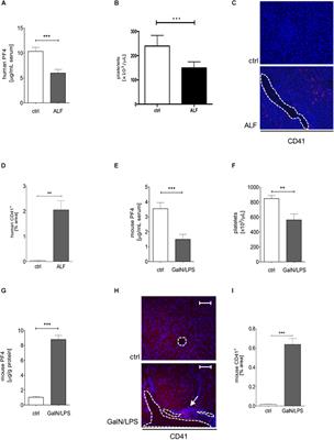 Platelet Factor 4 Attenuates Experimental Acute Liver Injury in Mice